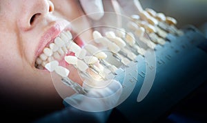 checking young woman's teeth color of dental artificial limb