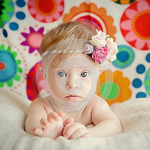 Cheerful little baby girl with Downs Syndrome