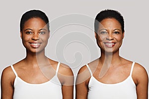 Cheerful smiling healthy young woman and senior women smiling on white background. Aging, cosmetology, plastic surgery
