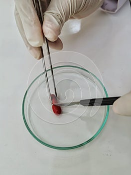 The Chemical in Glassware Test Test tube andâ€‹ plate In The madical Forensic Research and Development University Hospitalâ€‹