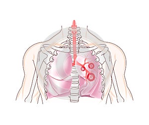 The chest is anatomically correct with lungs