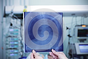 Chest x-ray against the backdrop of a hospital ward.