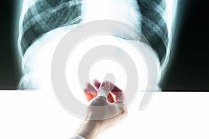 Chest x-ray in the doctor`s hand, prevention of pneumonia covid-19, diagnosis