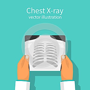 Chest X-ray vector