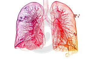 Pecho  tridimensional imagen  pulmones  tridimensional imagen 