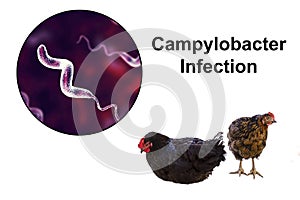 Chicken as the source of Campylobacter infection