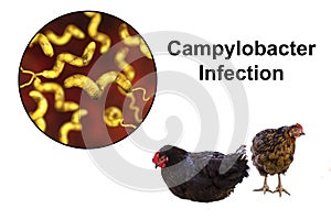 Chicken as the source of Campylobacter infection photo