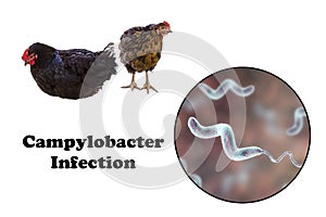 Chicken as the source of Campylobacter infection photo