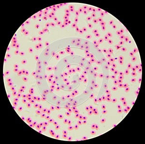 Chicken red blood cells under a microscope (blood smear Chicken)