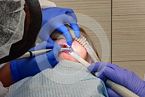 Child at the dentist. The dentist heals a tooth little girl. Children`s dentistry