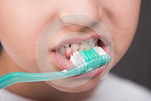 The child does a daily procedure to brushing his teeth