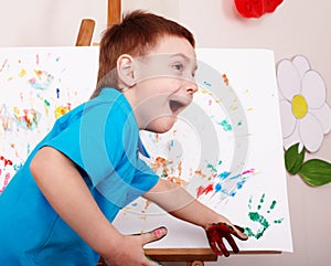 Child with easel draw hands.