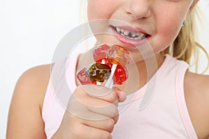 Child eats candy. Girl has caries on teeth