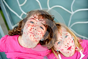 Child girls mischief pretending lipstick measles