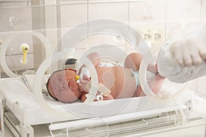 A child in an incubator. Neonatal and Premature Intensive Care Unit