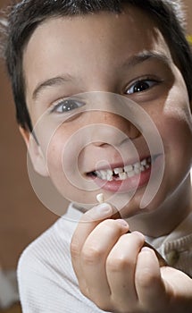Child with lost tooth