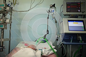 Child in the NICU connected to the life support device