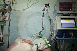Child in the NICU connected to the life support device photo