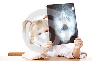 Child playing with X-ray photograph