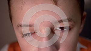 Child with Ptosis of Upper Eyelid, Long Lashes. Myopia. Opening and Close Eyes