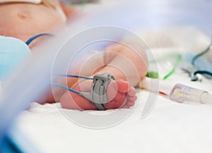 Child's foot with oximeter in ICU photo