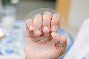 Child show her finger nails after cutting