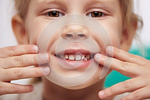 Child showing teeth