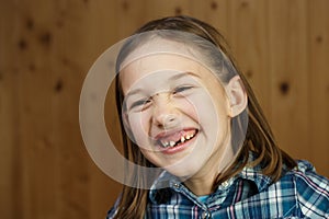 Child smiling, showing her missing milk teeth