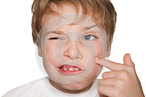 Child in white finger indicates pimple photo