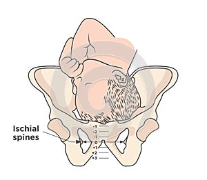 Child in womb - pelvis ischial spines - medical illustration