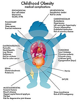 Childhood obesity photo