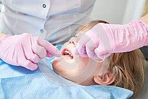 Children dentistry. Litle girl an dentist examination, teeth cleaning and treatment.