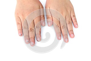 Children long nails isolated on white background. Children dirty nails isolated. Unclean nails isolated. Children nails isolated photo