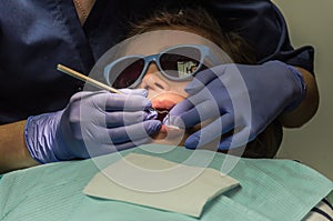 Children`s dentist treats baby teeth