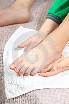 Children`s foot sprinkled with white powder lies on a white towel. Excessive sweating of the feet.