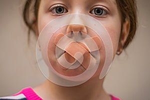 Children`s mouth sealed with a plaster close-up. The little girl`s mouth was covered with duct tape. A sad, scared child can`t