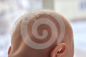 Children`s nape with sparse white hair, close-up