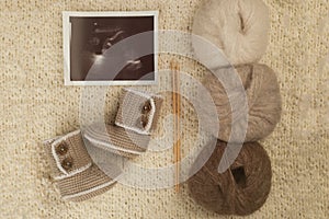 Children`s shoes and ultrasound of the baby`s fetus with a needles and yarn on soft knitted background. Cozy, warm winter