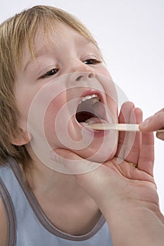 Childs tonsils are checked