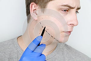 Chin lift - mentoplasty. A man at the reception at the plastic surgeon. Preparation for surgery photo