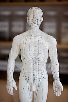 Chinese acupuncture model