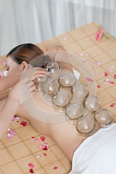 A Chinese medicine cupping of the young lady