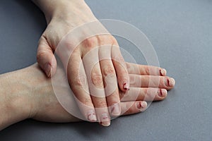 Chipped, stratified nails. nails after gel Polish. untidy hands on a gray background.the view from the top photo