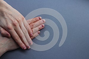 Chipped, stratified nails. nails after gel Polish. untidy hands on a gray background.the view from the top photo