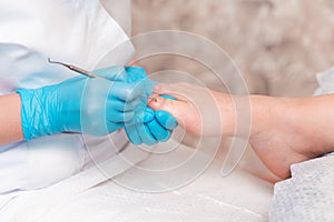 A chiropodist does a pedicure for the client& x27;s feet, cleaning the nails with a double-sided curette. Close up. The