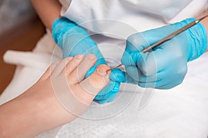 Chiropodist does a pedicure for the client& x27;s foot, cleaning the nails with a double-sided curette. Close up. The