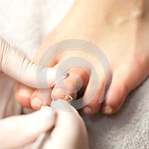 Chiropody photo