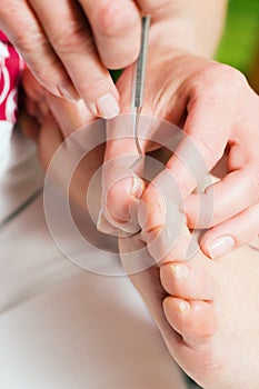 Chiropody - foot care photo