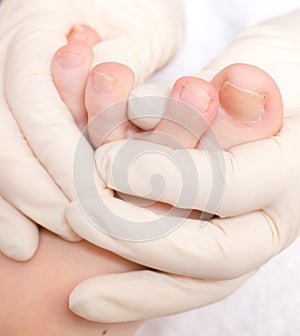 Chiropody photo