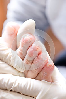 Chiropody photo